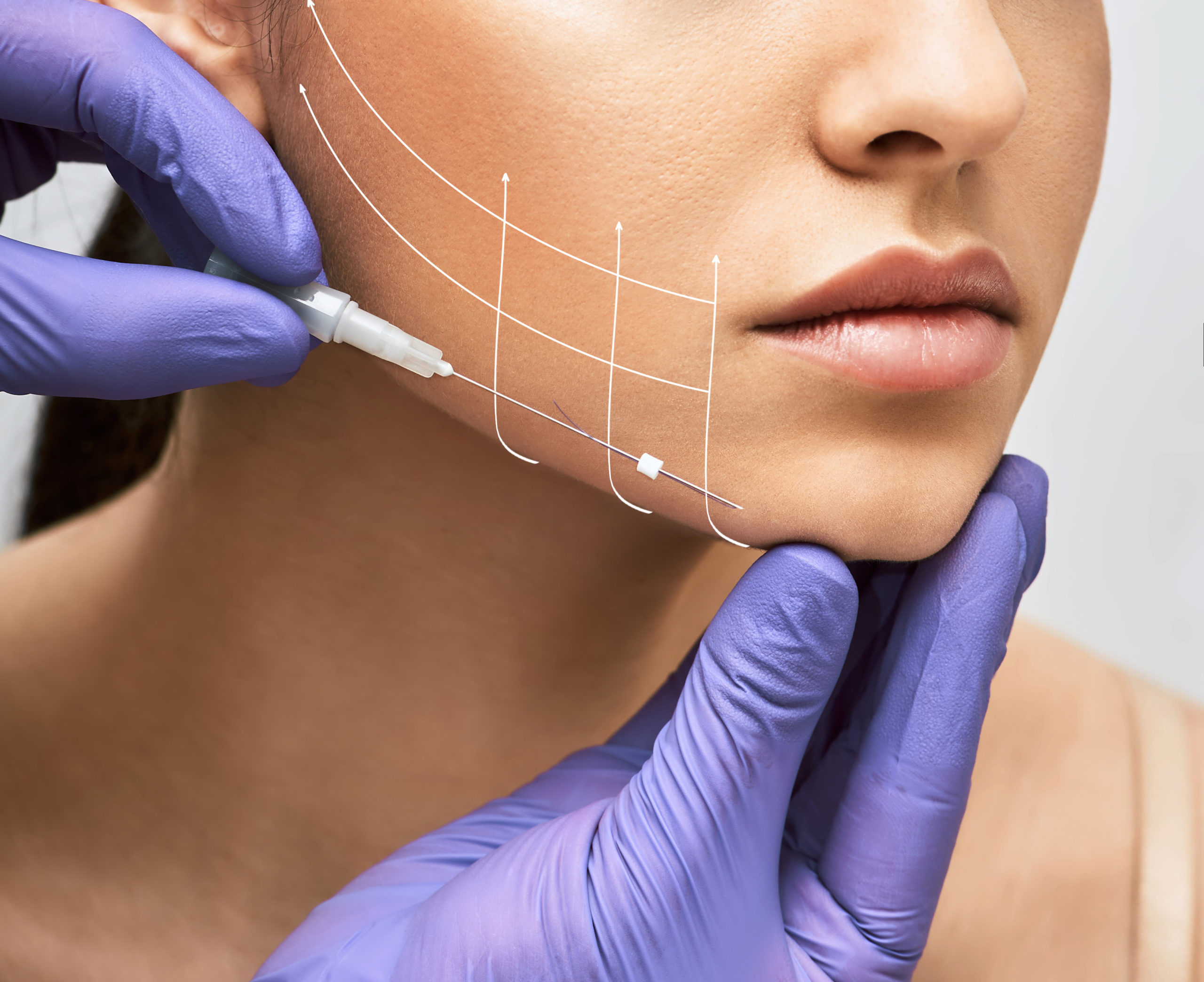 Why Threading Is One Of The Best Alternatives To A Facelift
